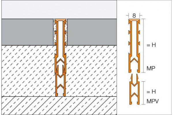 Dilatação Dilex-MP